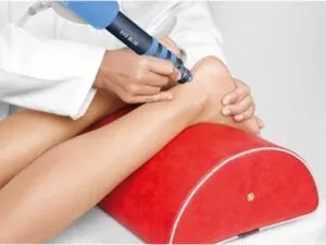 Shockwave Therapy